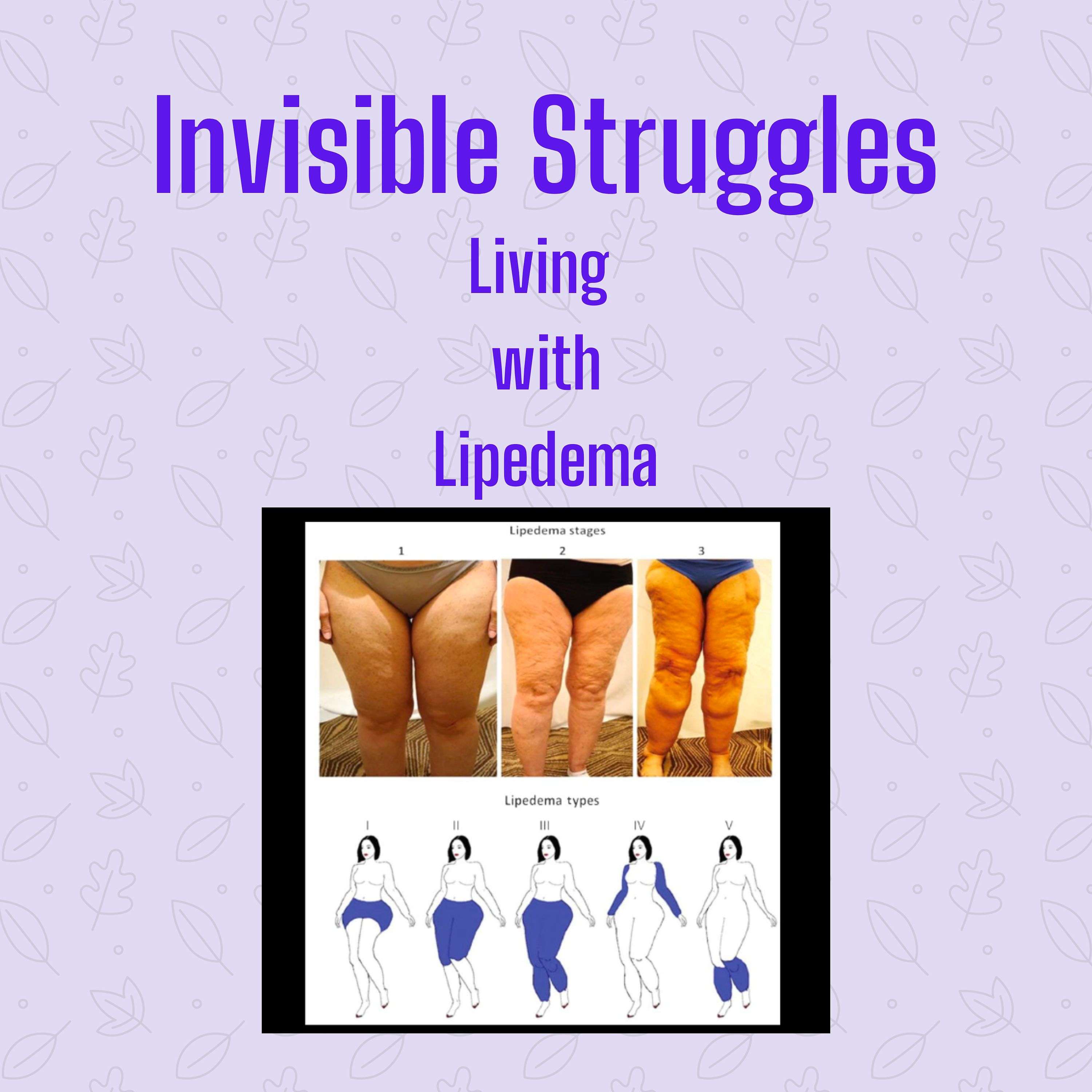 Invisible Struggles: Living with Lipedema 