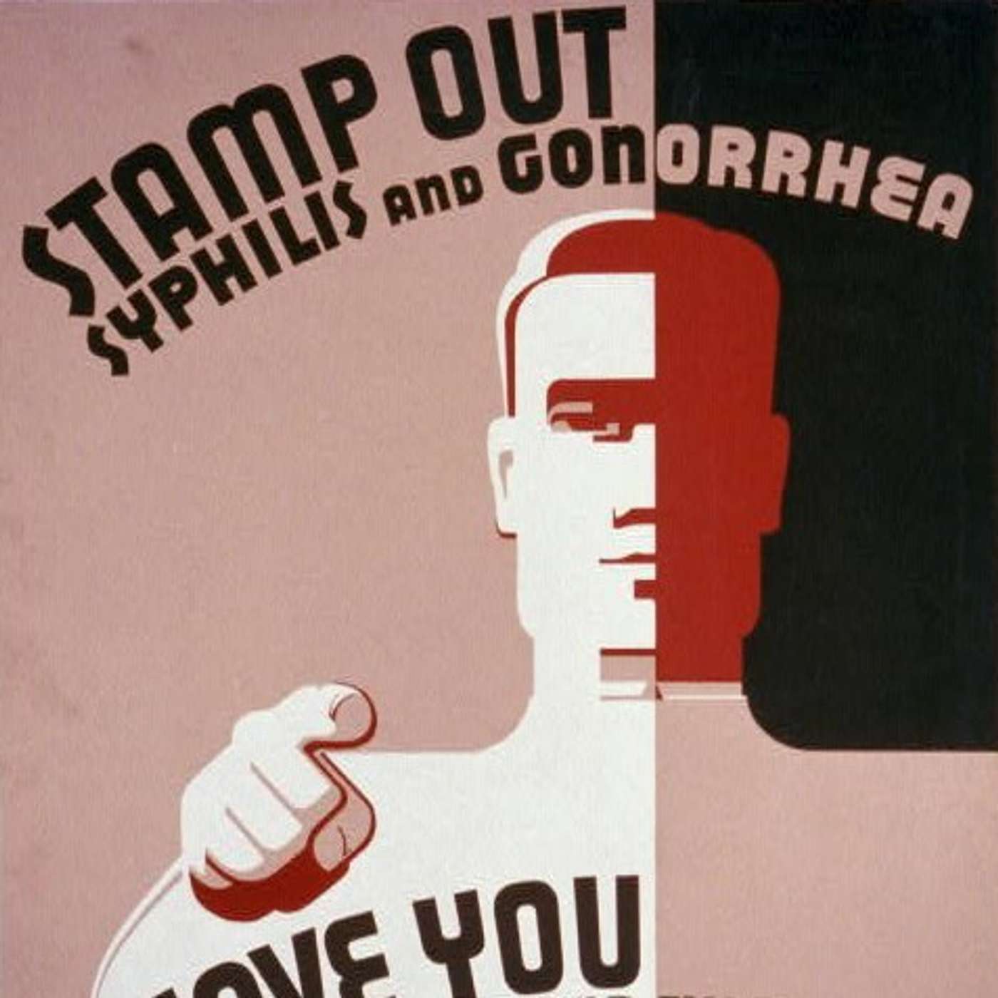 Ep149: Could it be syphilis? episode artwork