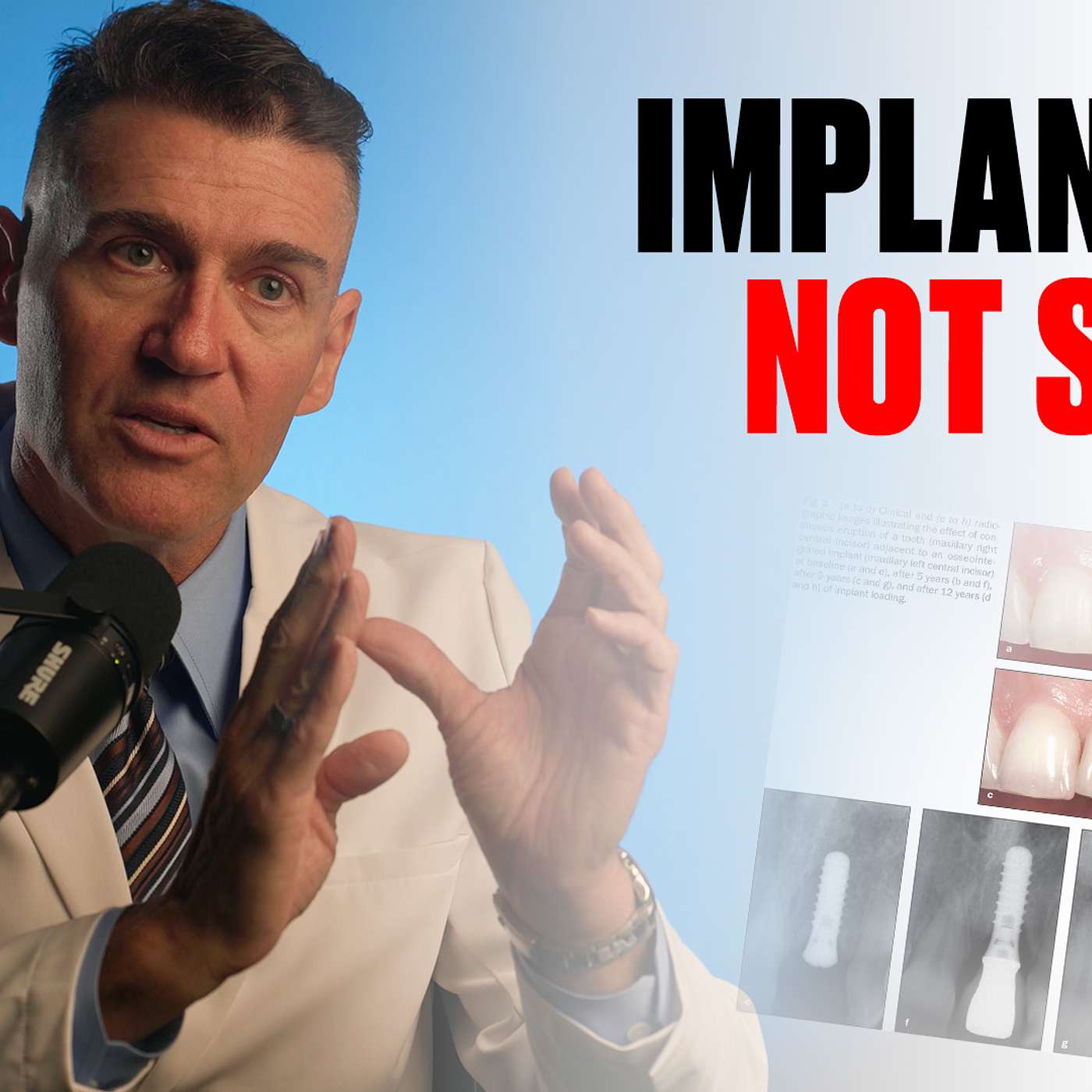 WHY You Implants Drift Over Time (and How to Fight It) episode artwork