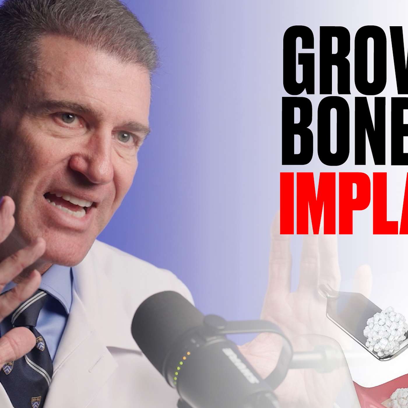 Implants Made Simple