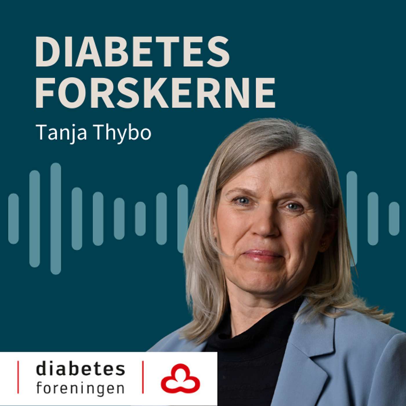 Mange med type 2-diabetes ændrer madvaner efter 14 dage med blodsukkersensor på armen