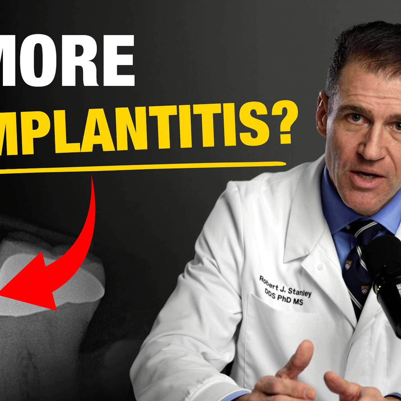 Implants Made Simple