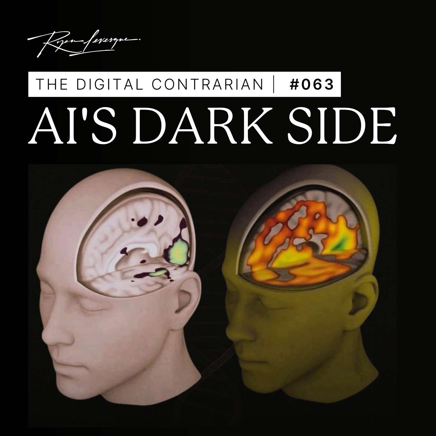 TDC 063: 5 AI Infographics That Will Blow Your Mind TDC 063: 5 AI Infographics That Will Blow Your Mind