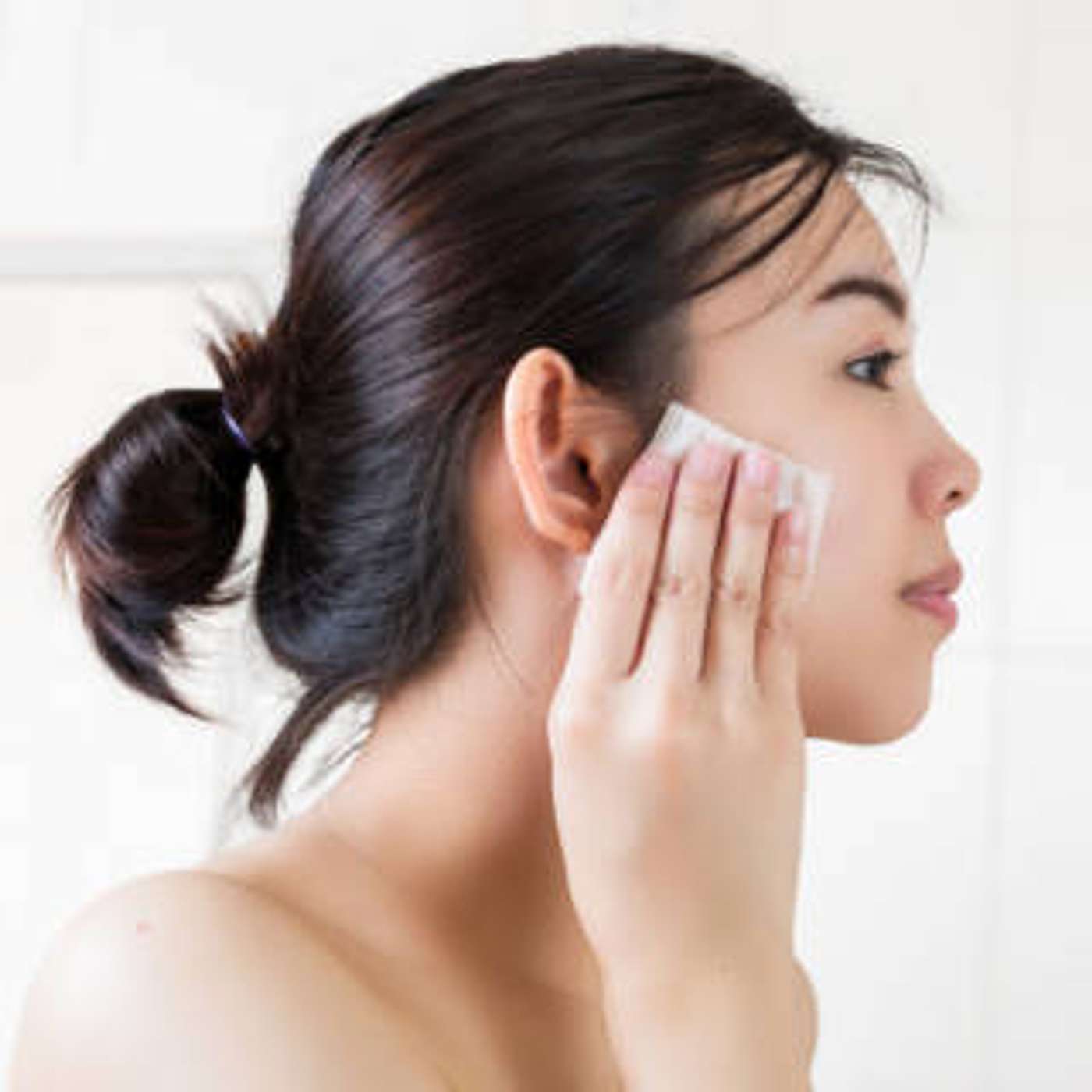 cover of episode Acne