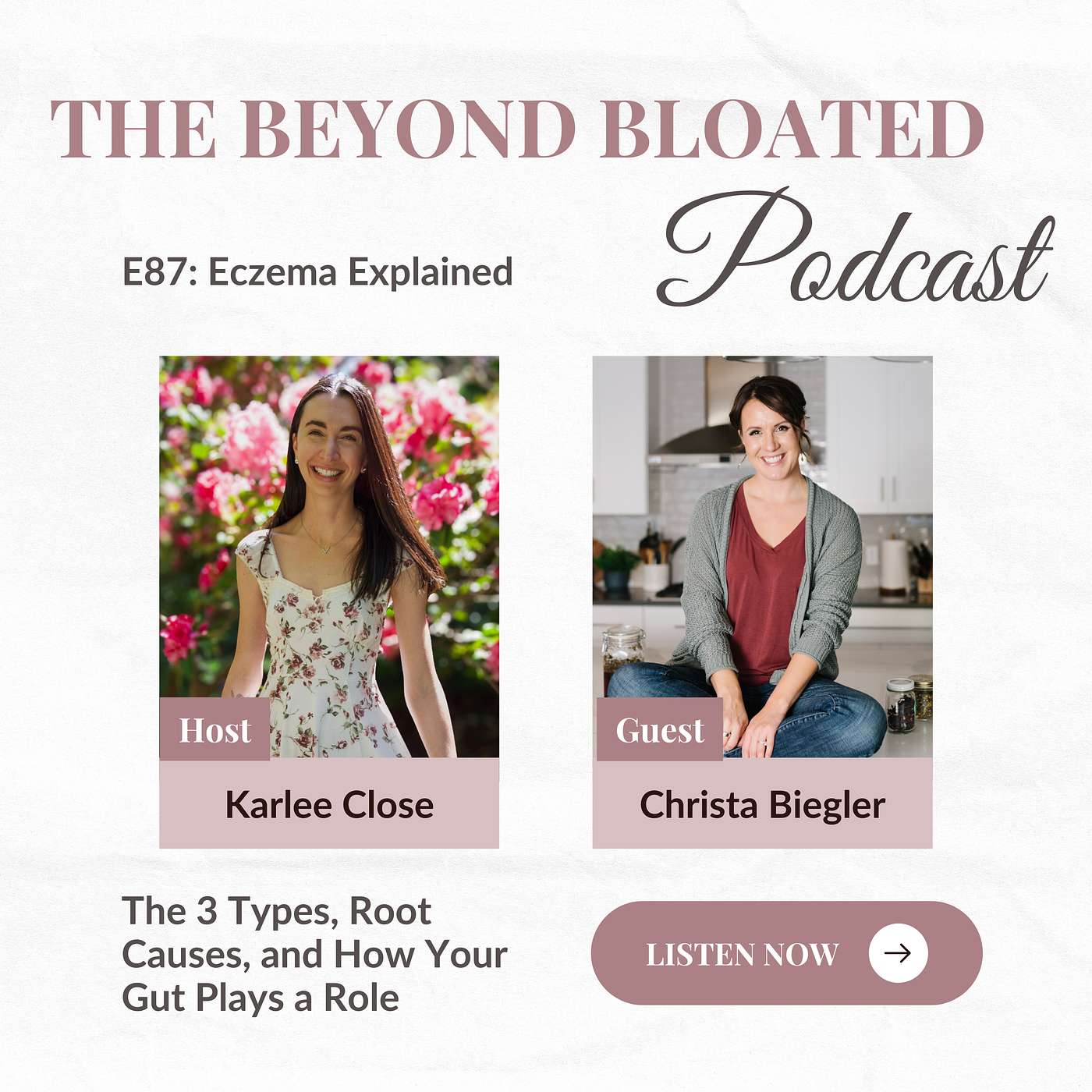 E88: Eczema Explained: The 3 Types, Root Causes, and How Your Gut Plays a Role
