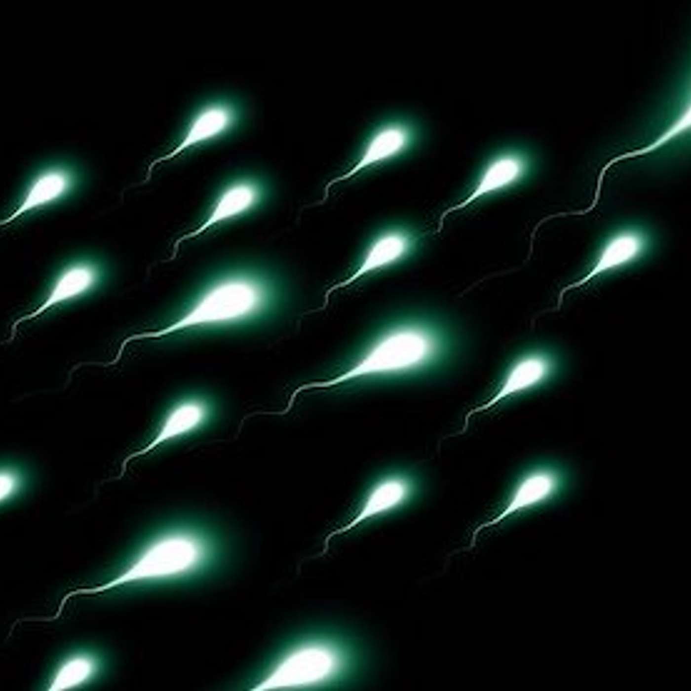 Home Insemination with Donor Sperm