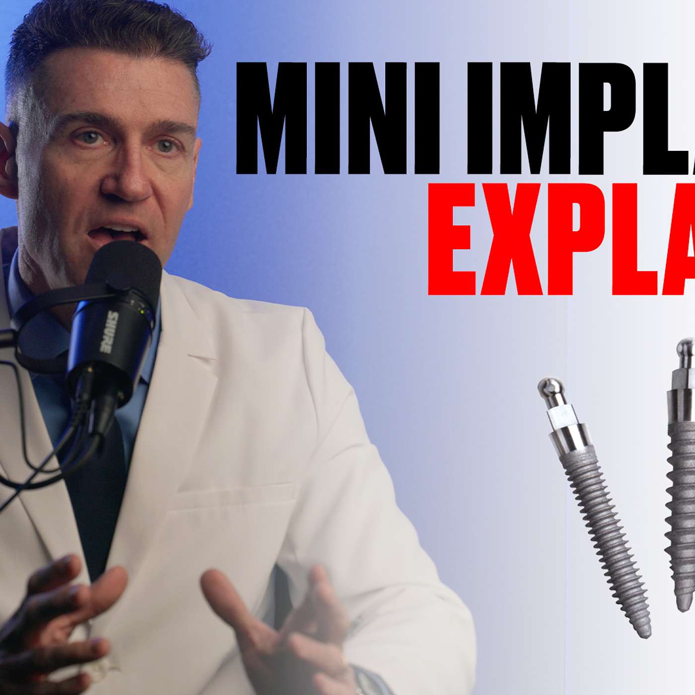 Implants Made Simple