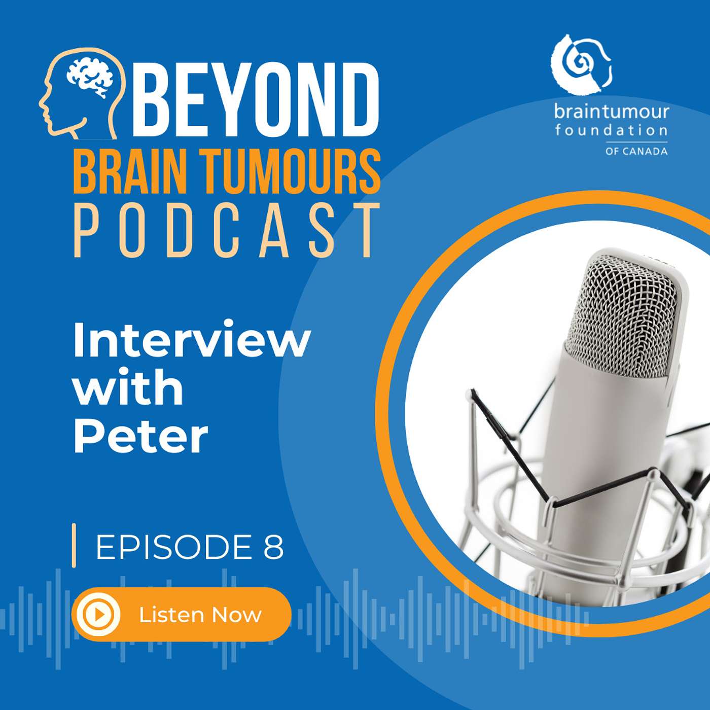 Beyond Brain Tumours