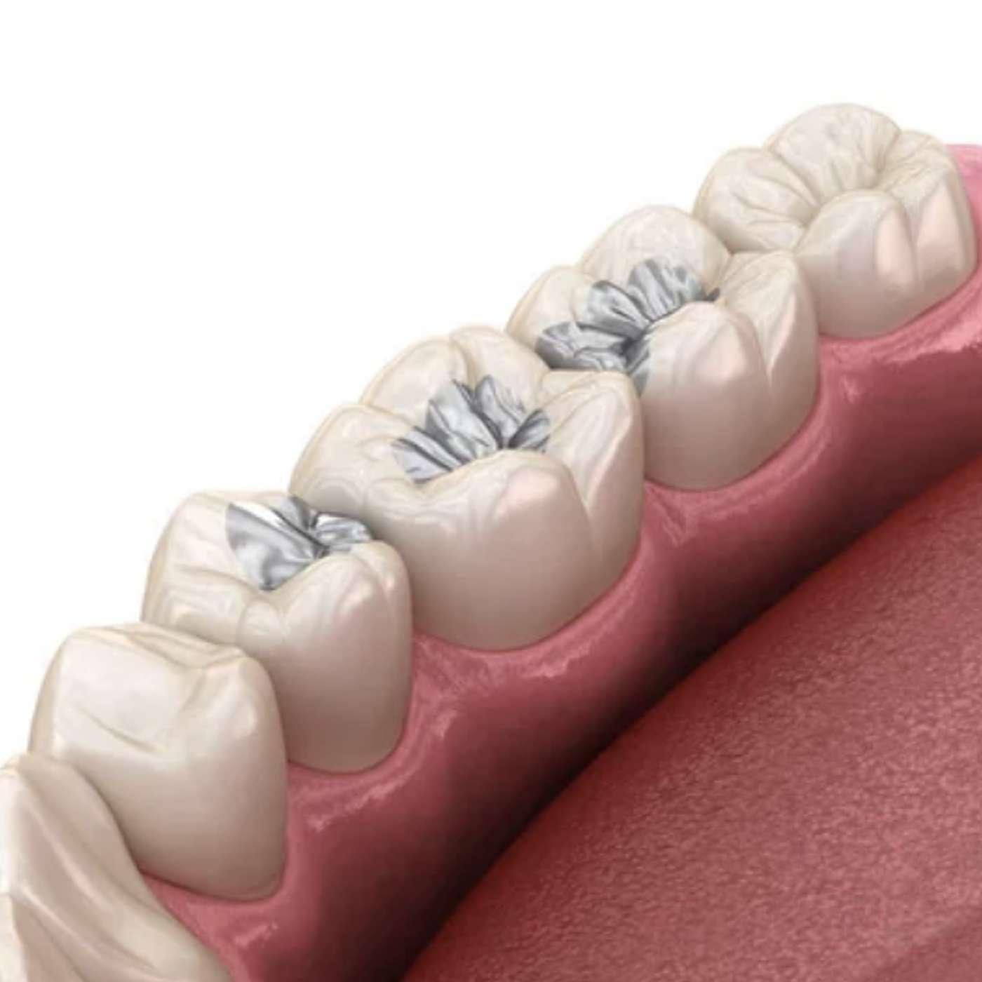 Mercury Fillings: What You Need to Know episode artwork