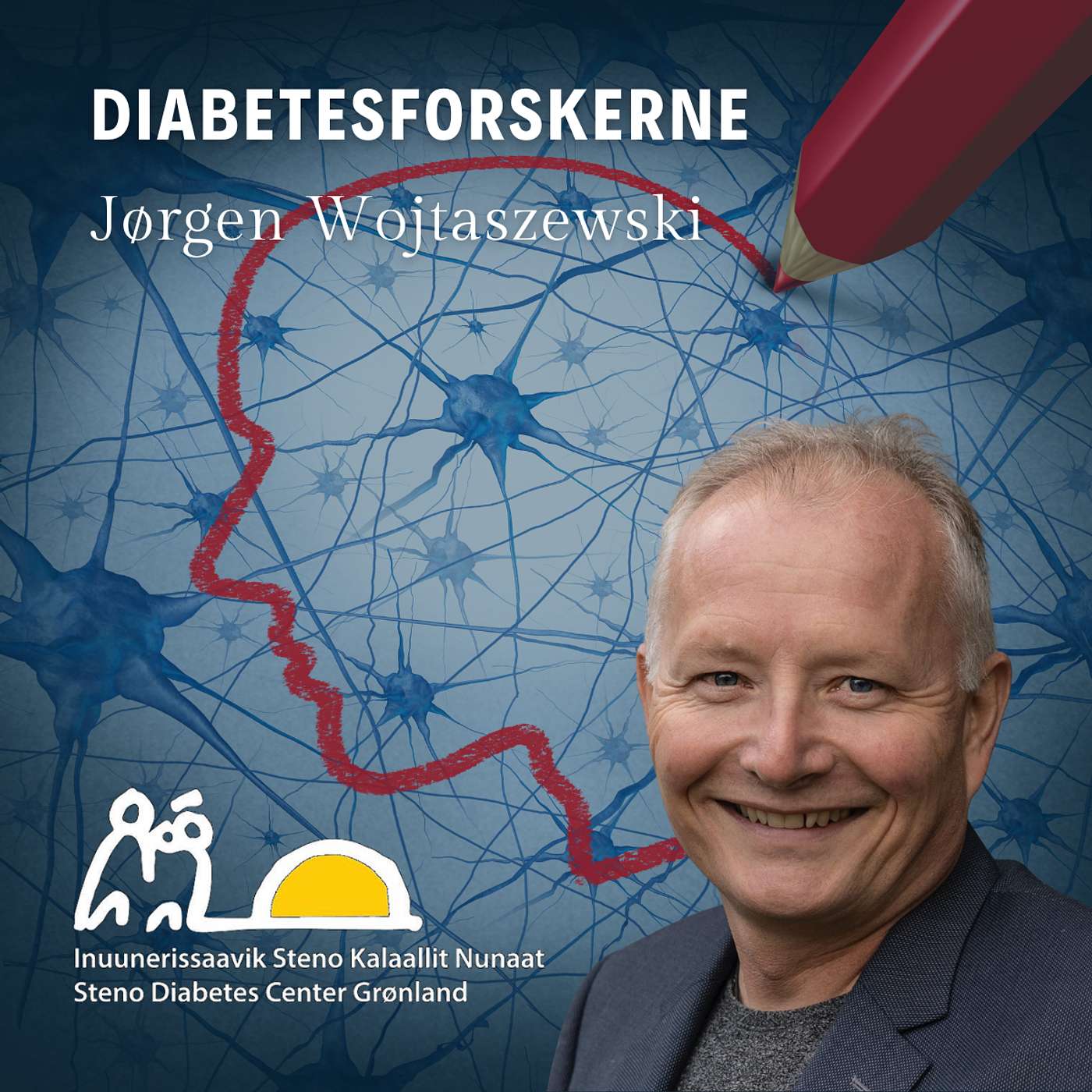 Fysisk aktivitet kan måske forebygge type 2-diabetes hos bærere af sjælden genvariant blandt inuit