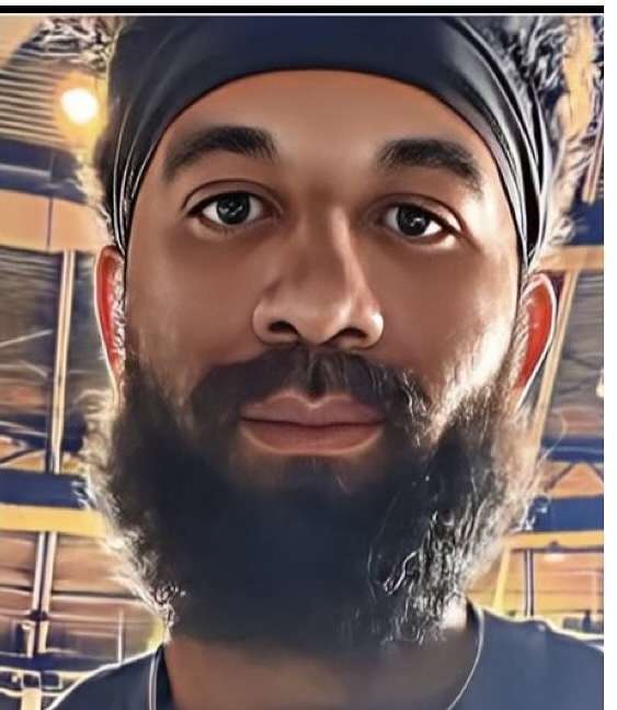 DP