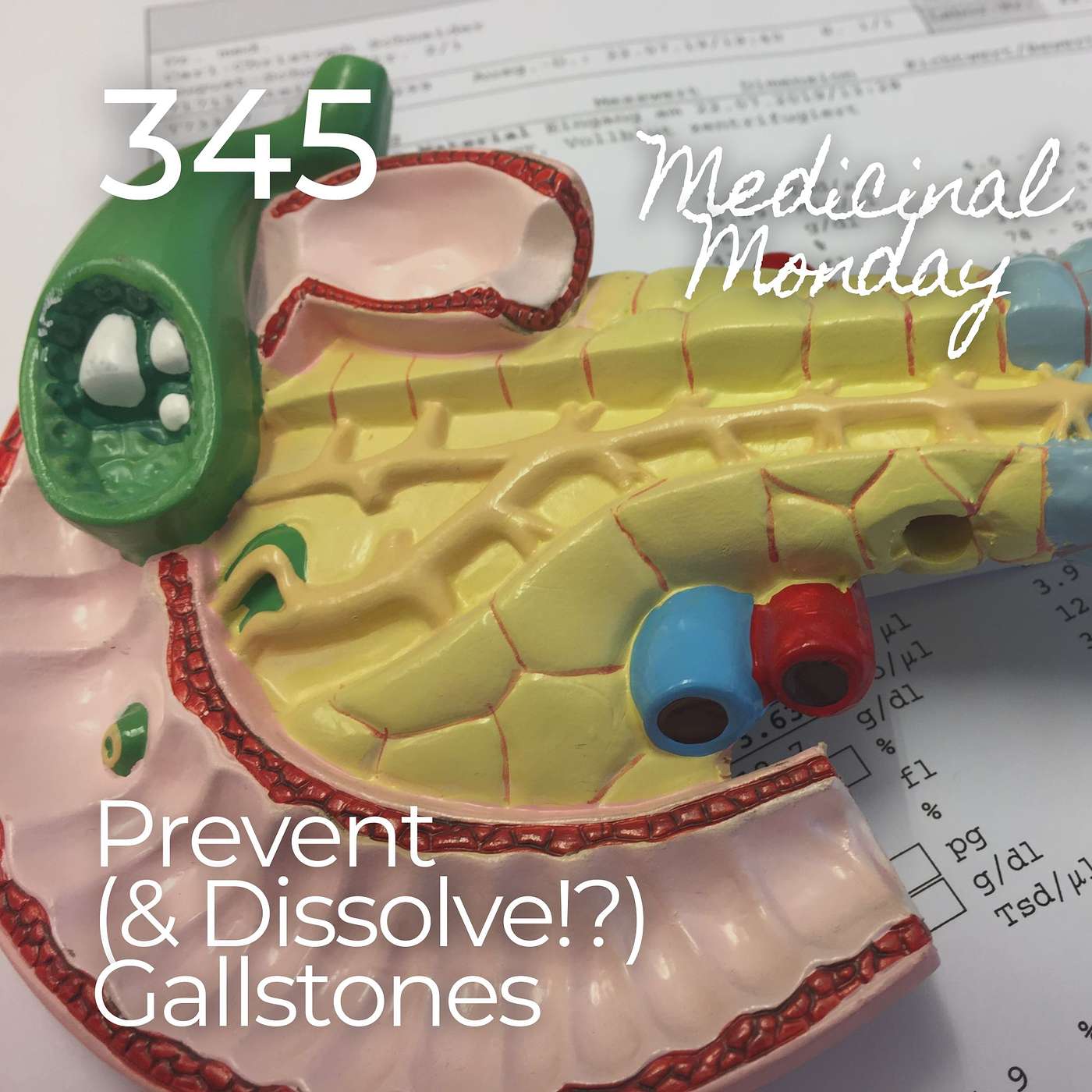 #345 | MM - Prevent (& Dissolve!?) Gallstones