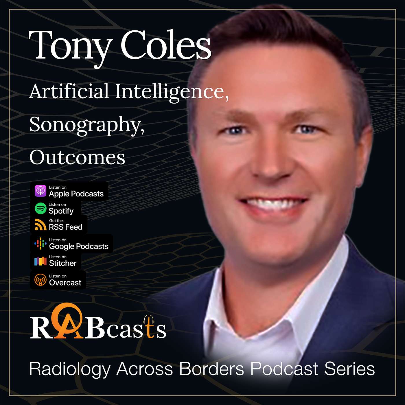 The Potential Impact of Artificial Intelligence on Sonography - Tony Coles, CEO, Australasian Sonographers Association (ASA)