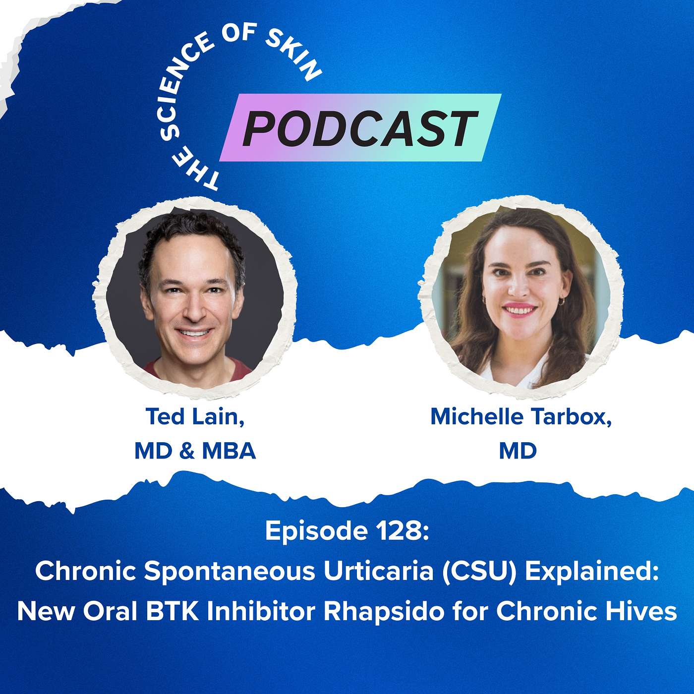 Chronic Spontaneous Urticaria (CSU) Explained: New Oral BTK Inhibitor Rhapsido for Chronic Hives
