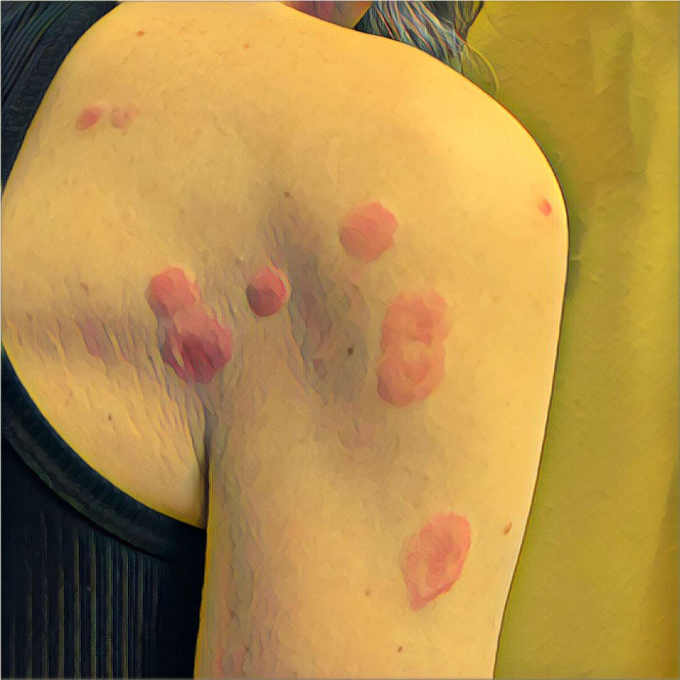 Arizona Trail: bedbug infestation