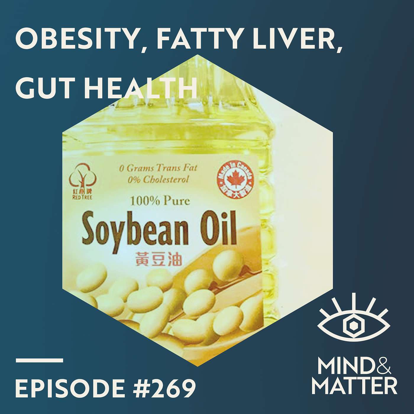 Soybean Oil: Obesity, Fatty Liver Disease, Gut Health, IBS & Colitis | Frances Sladek | 269 Soybean Oil: Obesity, Fatty Liver Disease, Gut Health, IBS & Colitis | Frances Sladek | 269