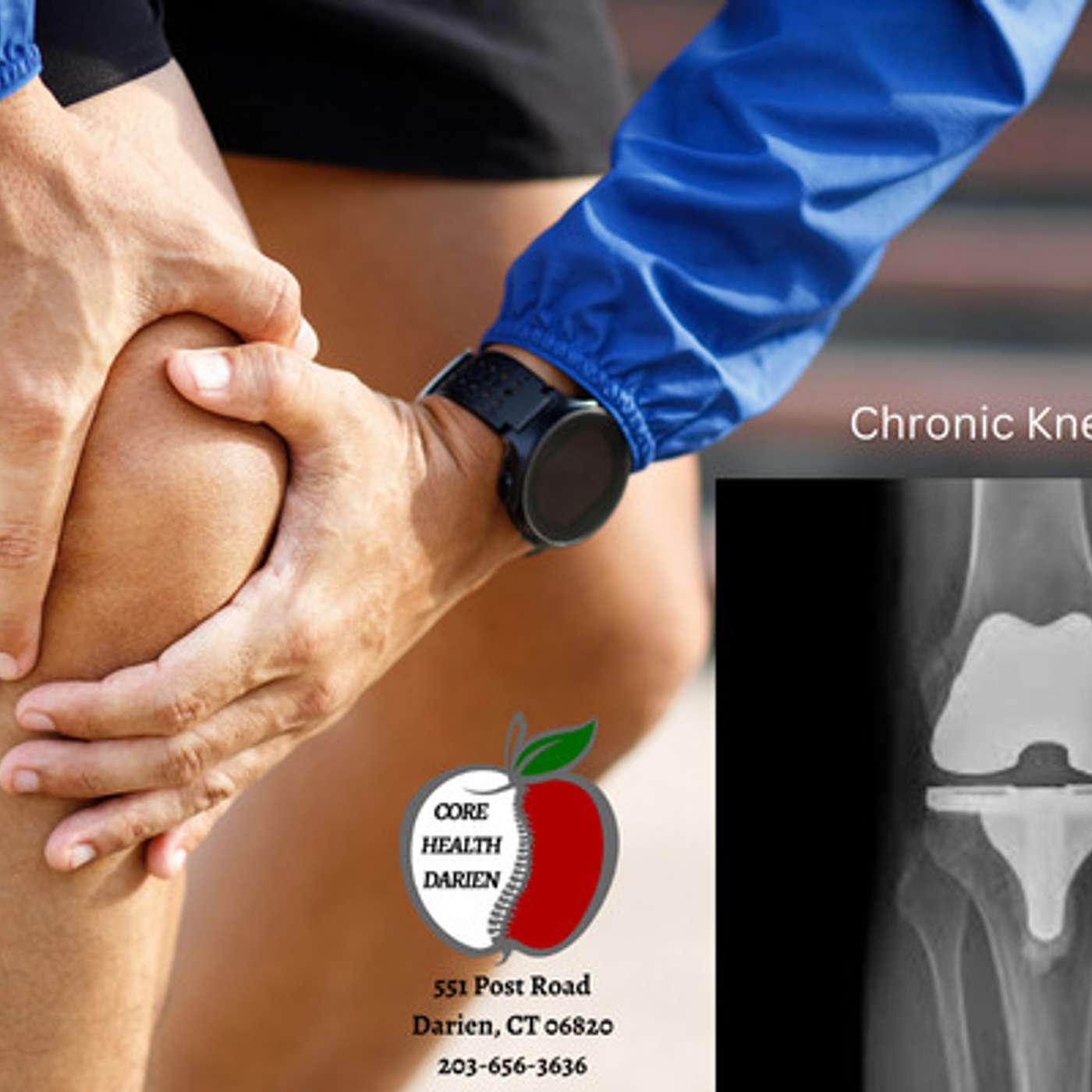 Chronic Knee Pain Stamford Darien New Canaan episode artwork