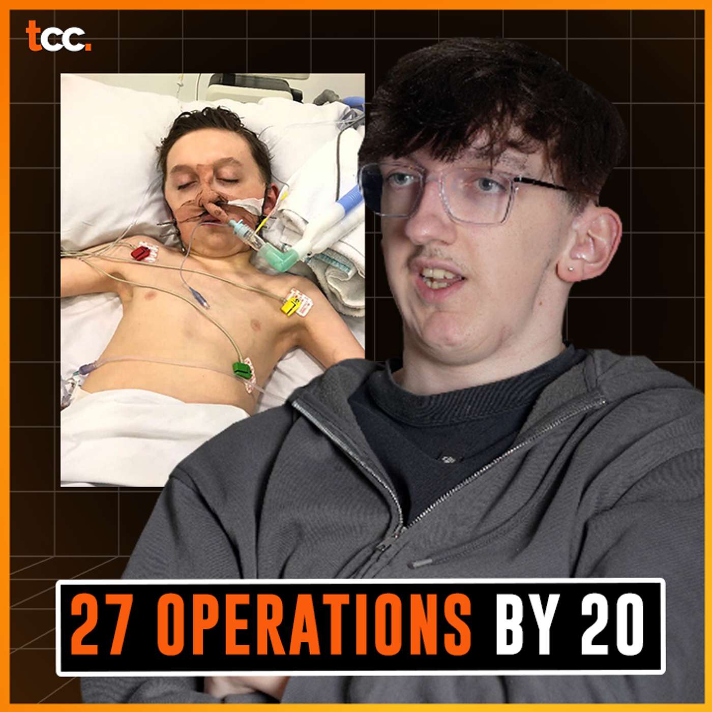 27 Operations before the age of 20 (GRIPPING STORY): Oliver Donnison | E151