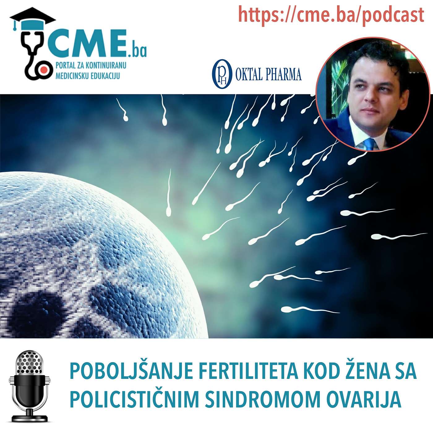 Poboljšanje fertiliteta kod žena sa policističnim sindromom ovarija