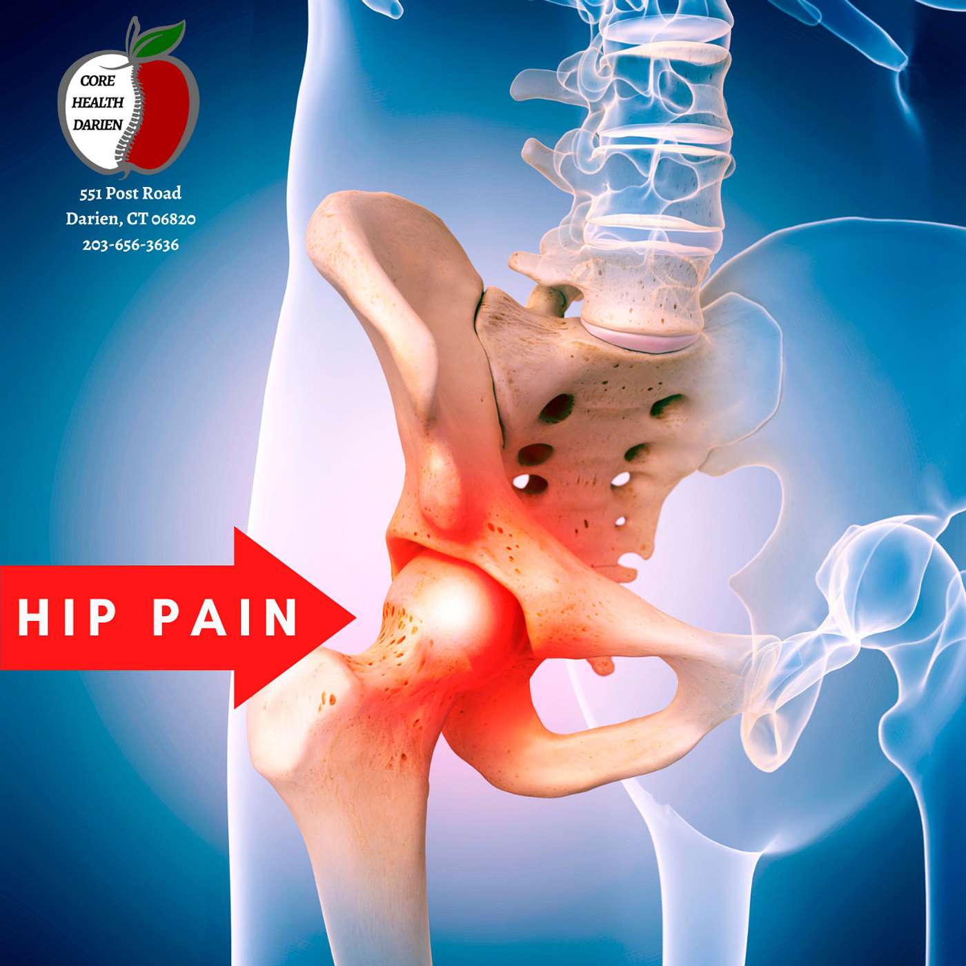 Hip Pain Darien | Stamford CT| Core Health Darien 203-656-3636 episode artwork
