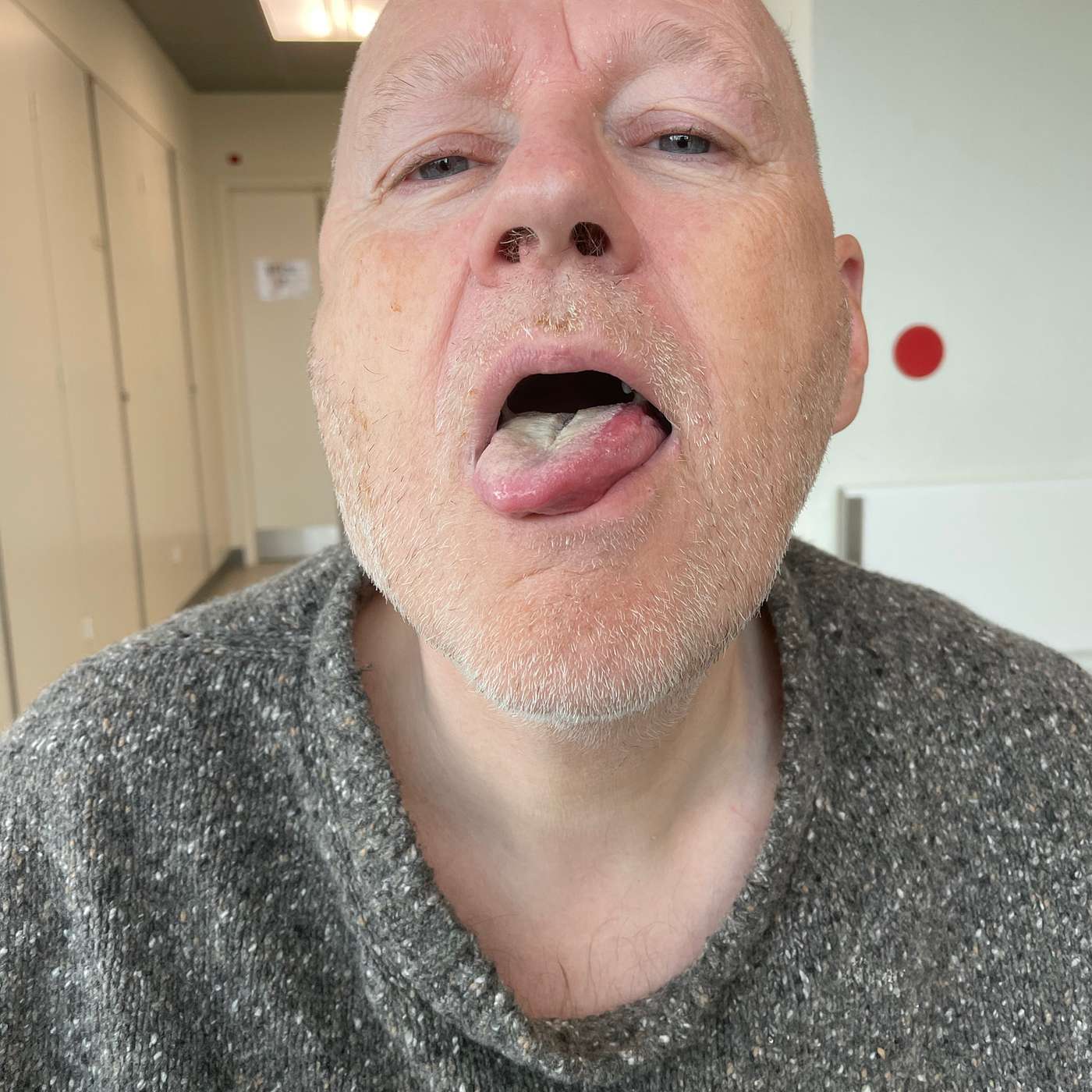 Erik Nielsen fortæller