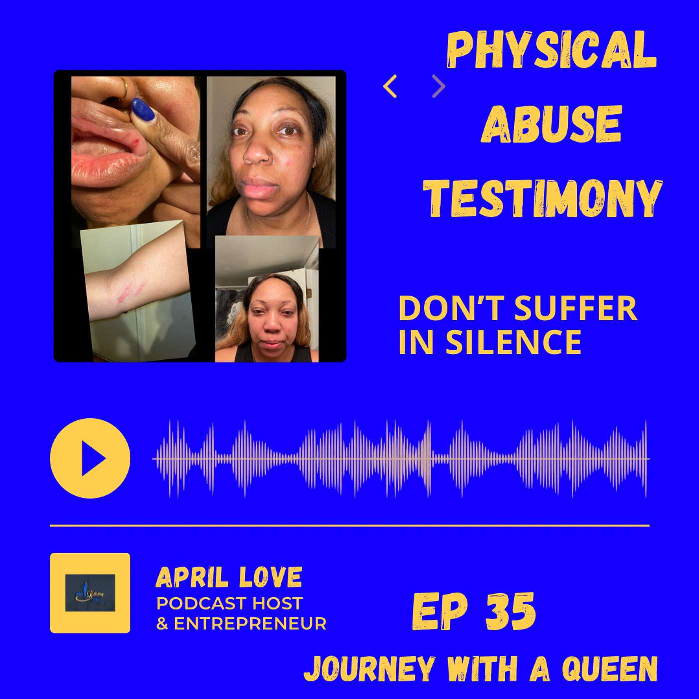 Physical Abuse Testimony