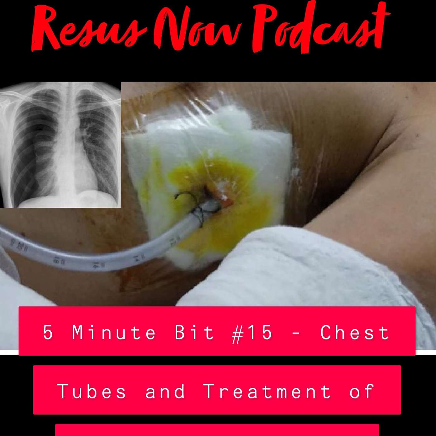 Resus Now