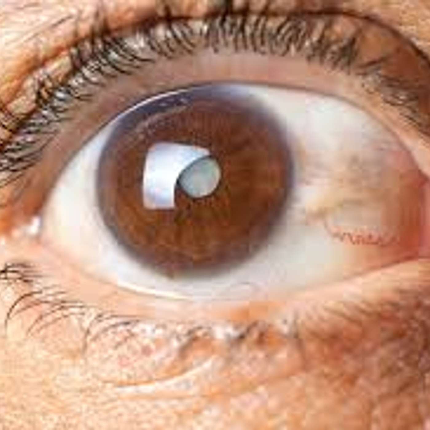 Season 4: Episode 4: The Silent Thief of Sight - Glaucoma Awareness! episode artwork