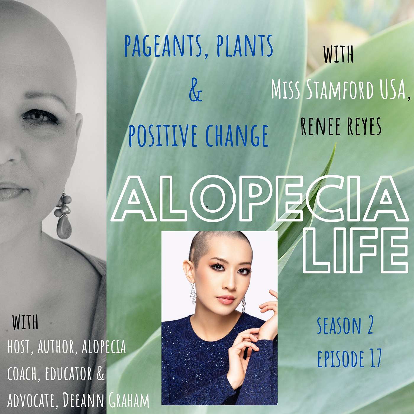 Alopecia Life - S2E17 Pageants, Plants & Positive Change, with Miss Stamford USA, Renee Reyes