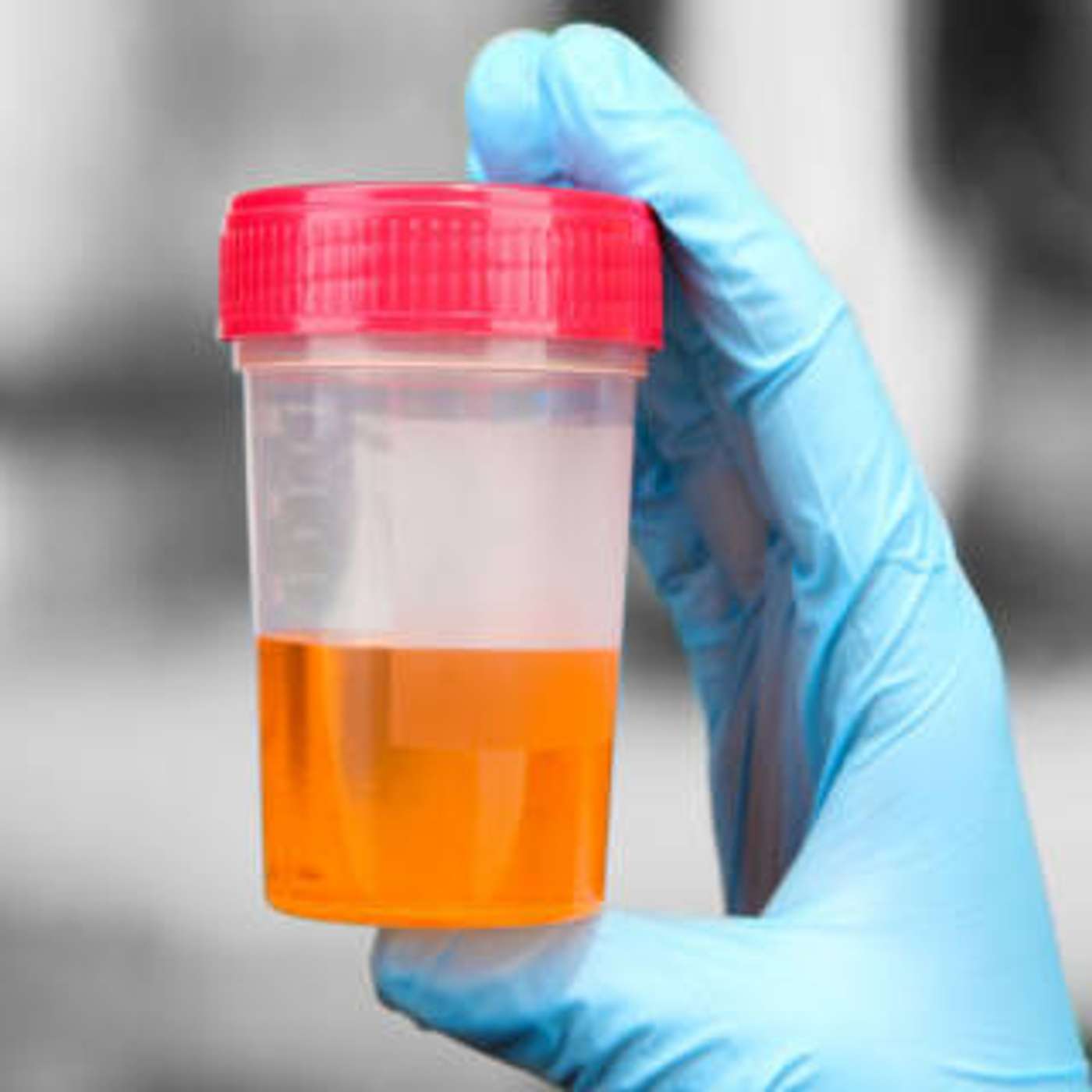 cover of episode Kidney Infection