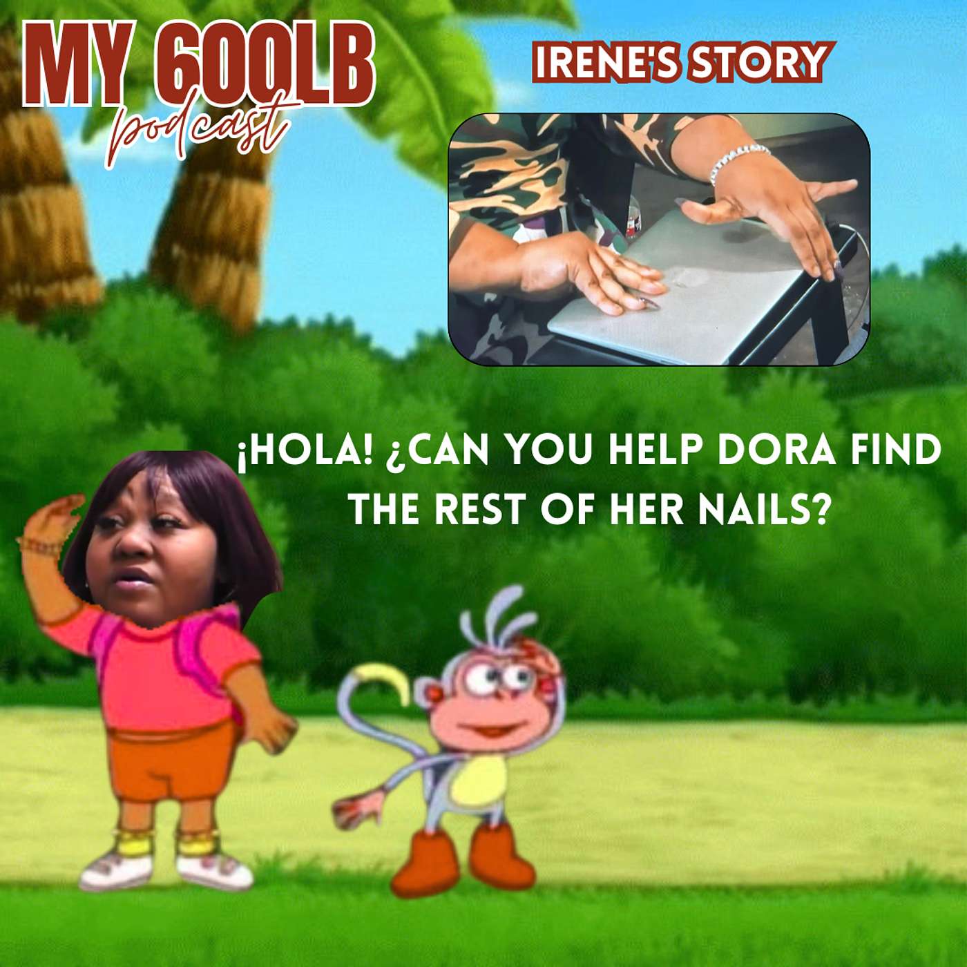 My 600lb Life S9E11 Irene’s Story