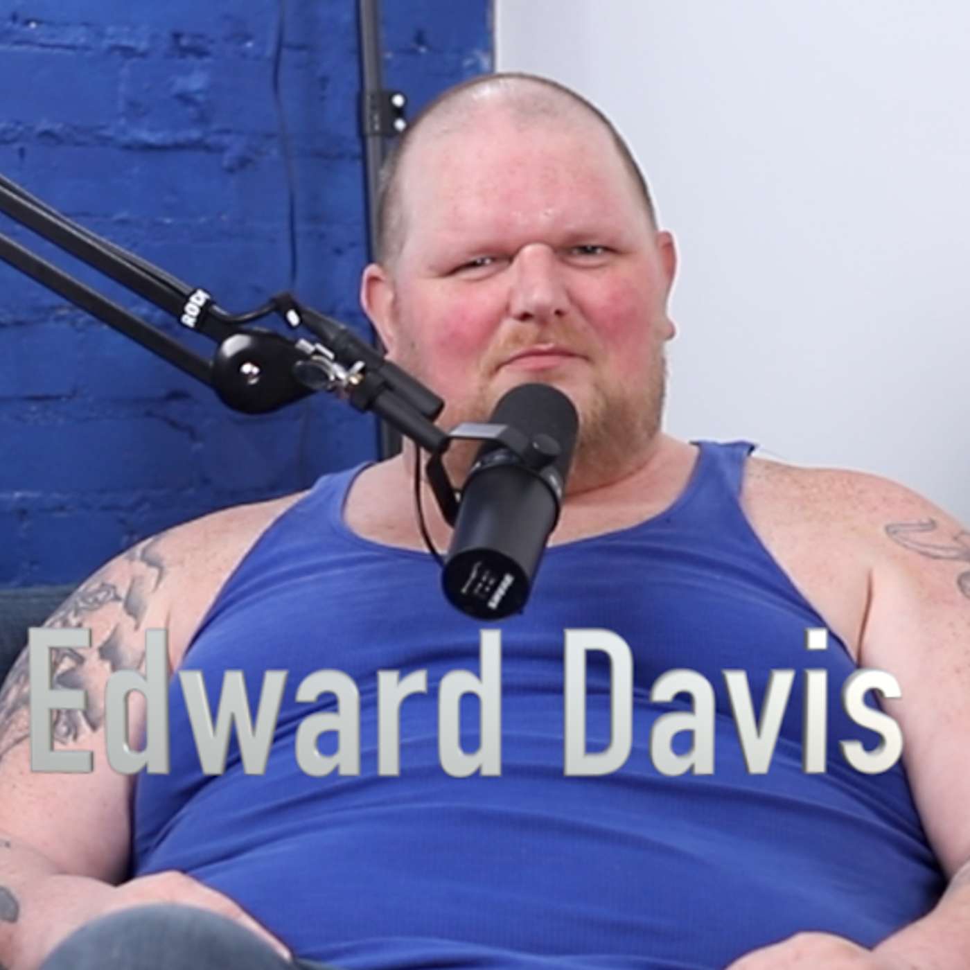 Content Creator Edward Davis Just Lost his Leg to an Infection!-PropertyTales