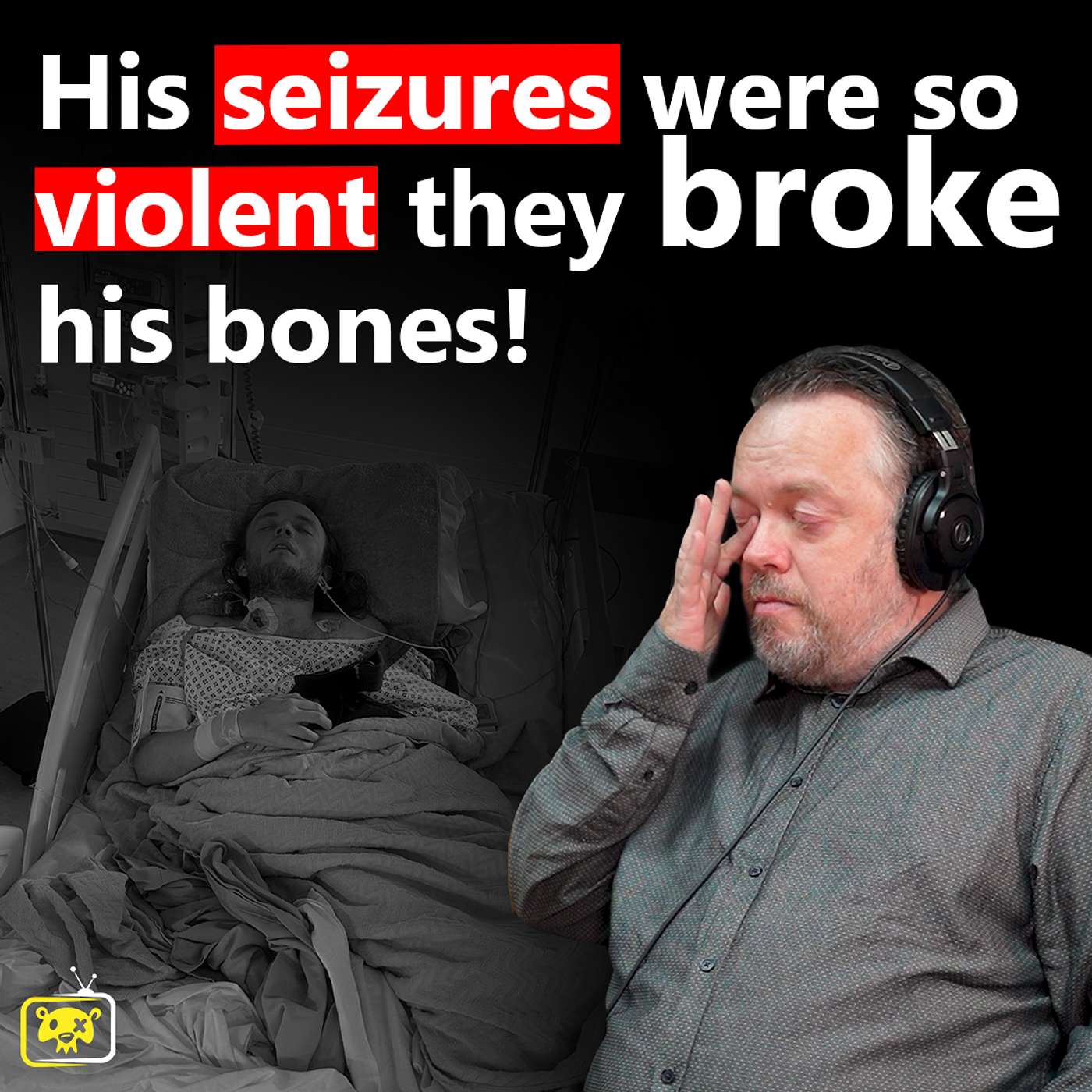 His Seizures were so Violent they broke his bones!