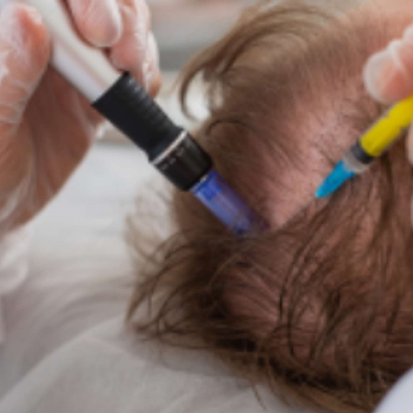 Alopecia in Clinical Practice: Recognition to Regenerative Therapies - N592 episode artwork