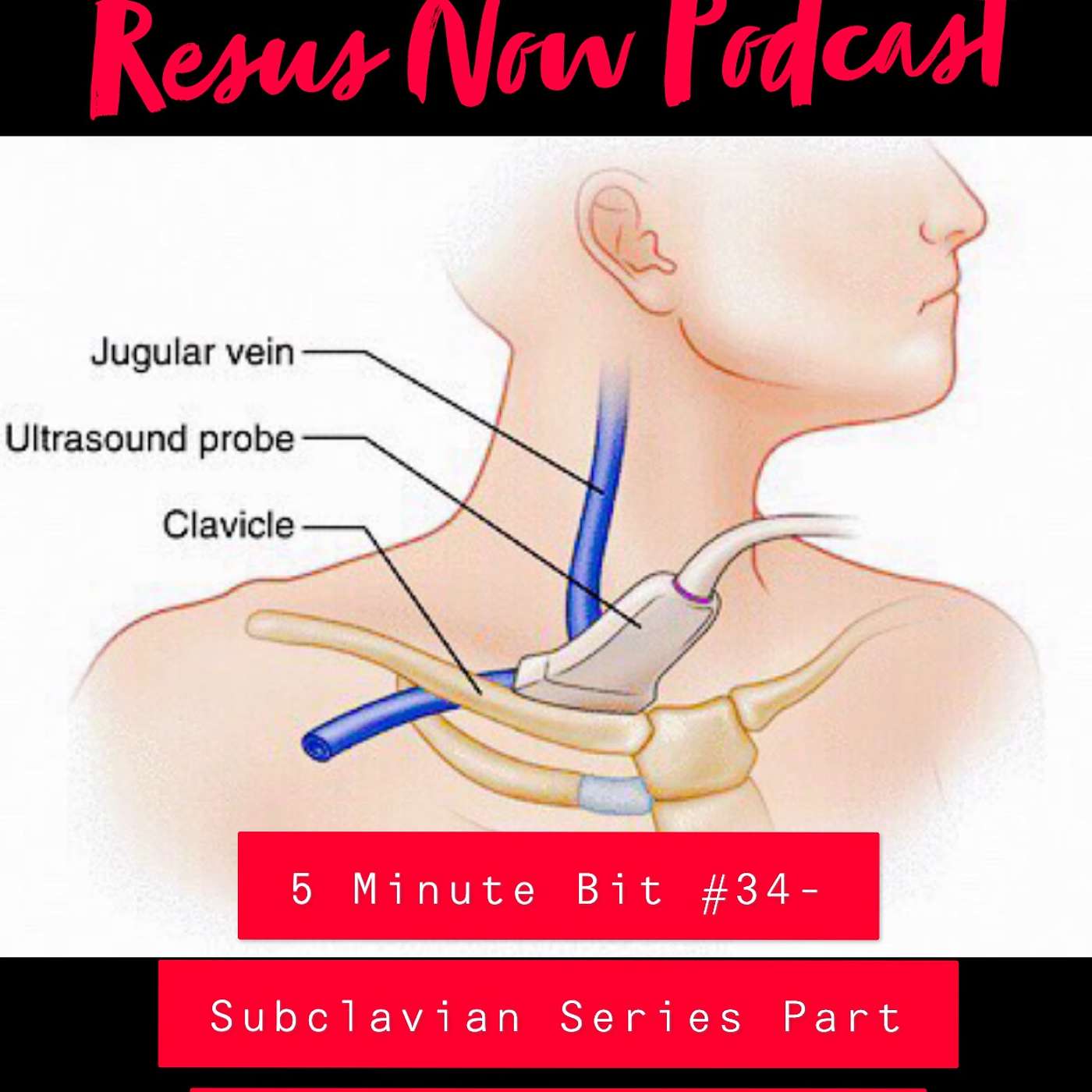 Resus Now