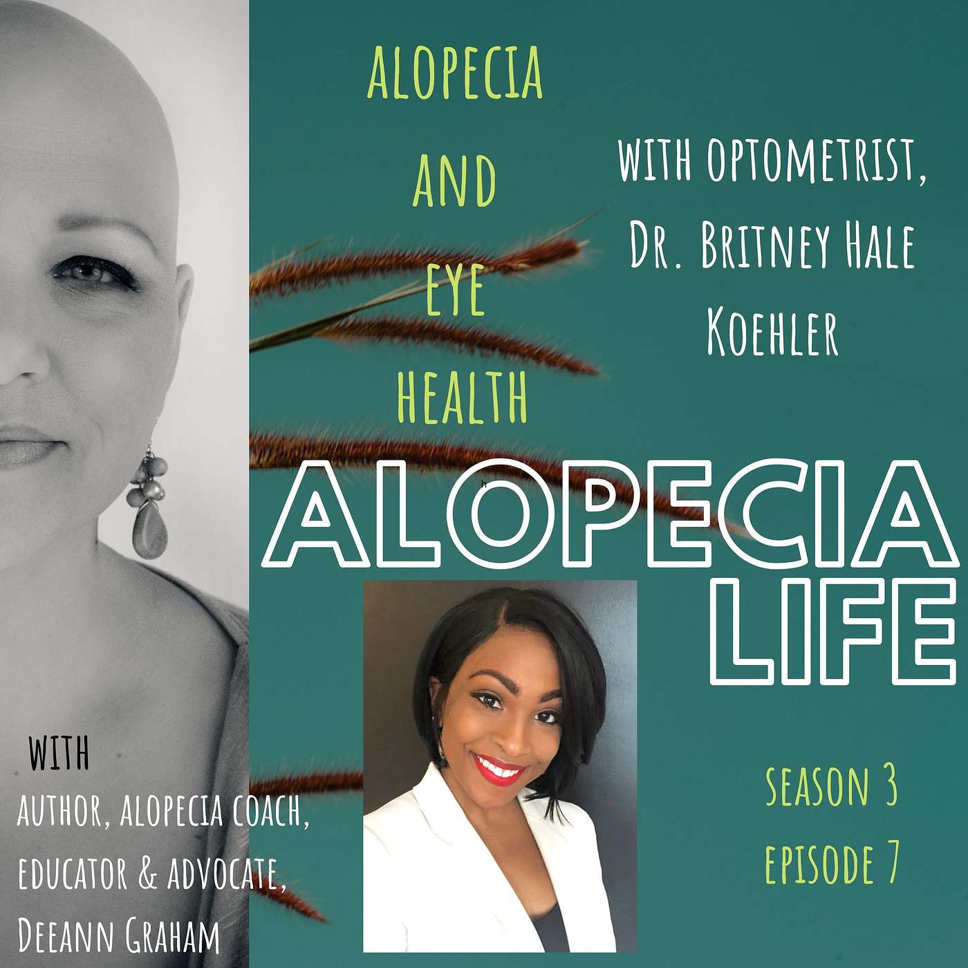 Alopecia Life - S3E7 Alopecia & Eye Health with Dr. Hale