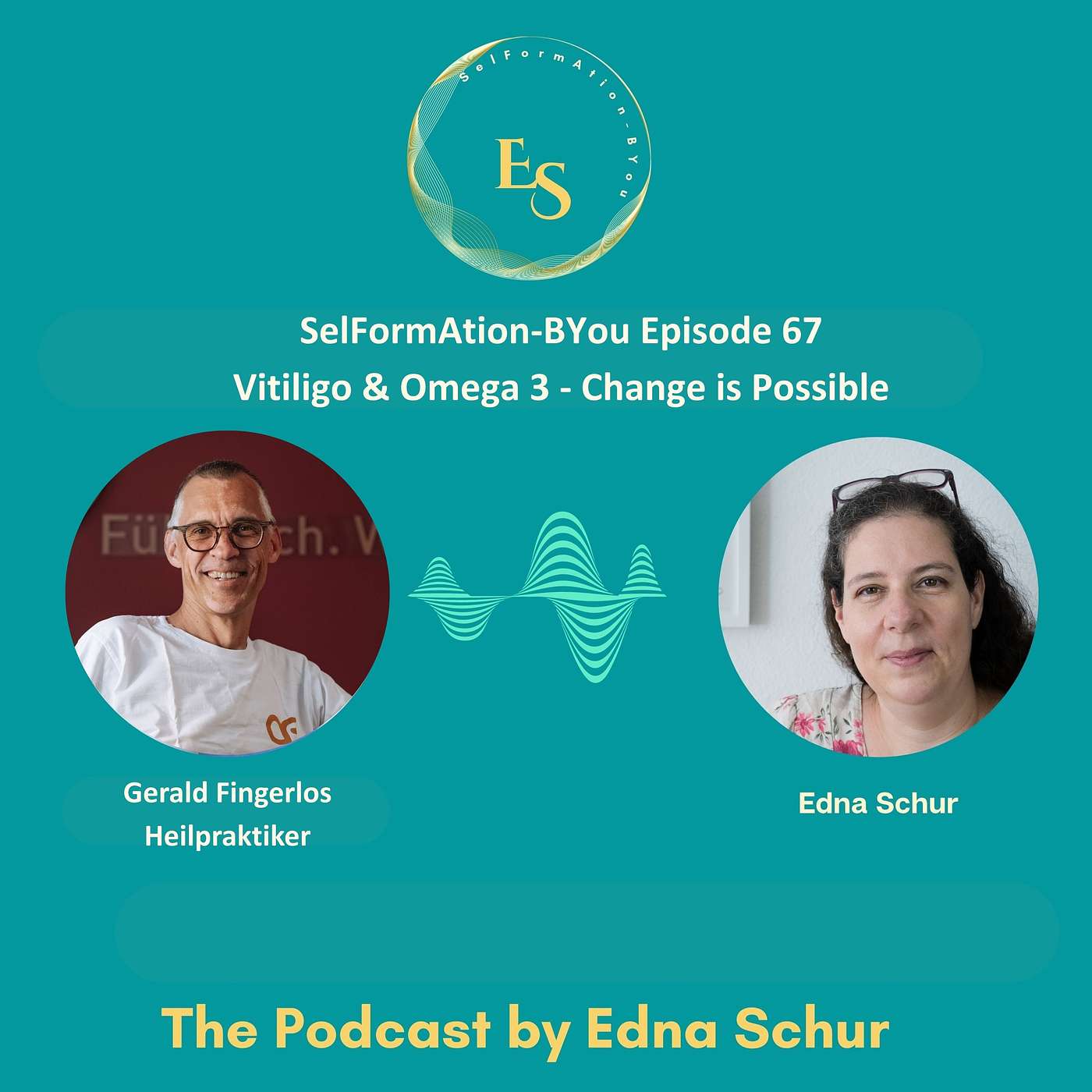 Episode 67 - Vitiligo & Omega 3 - Change is POSSIBLE