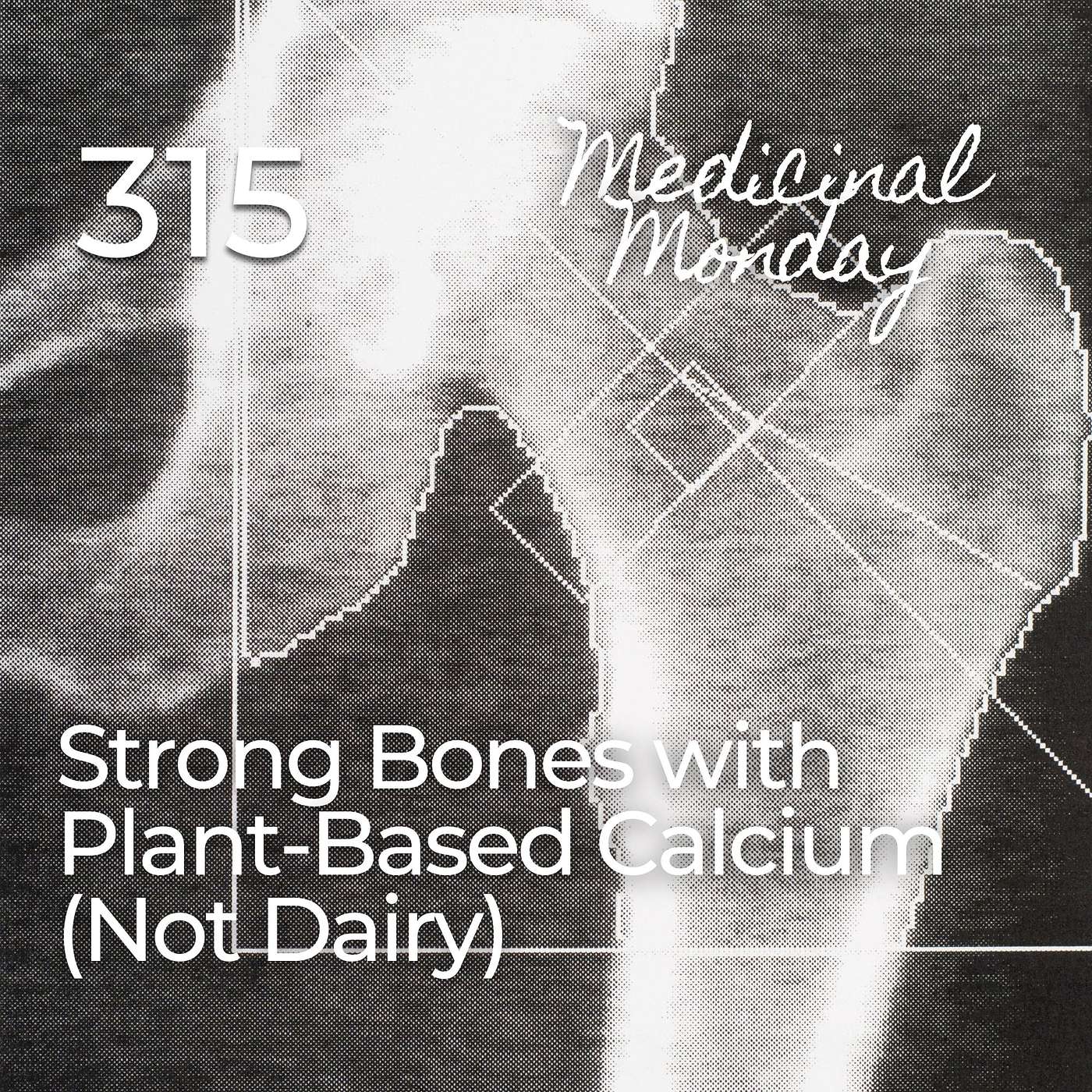 #315 | MM - Strong Bones with Plant-Based Calcium (not dairy)