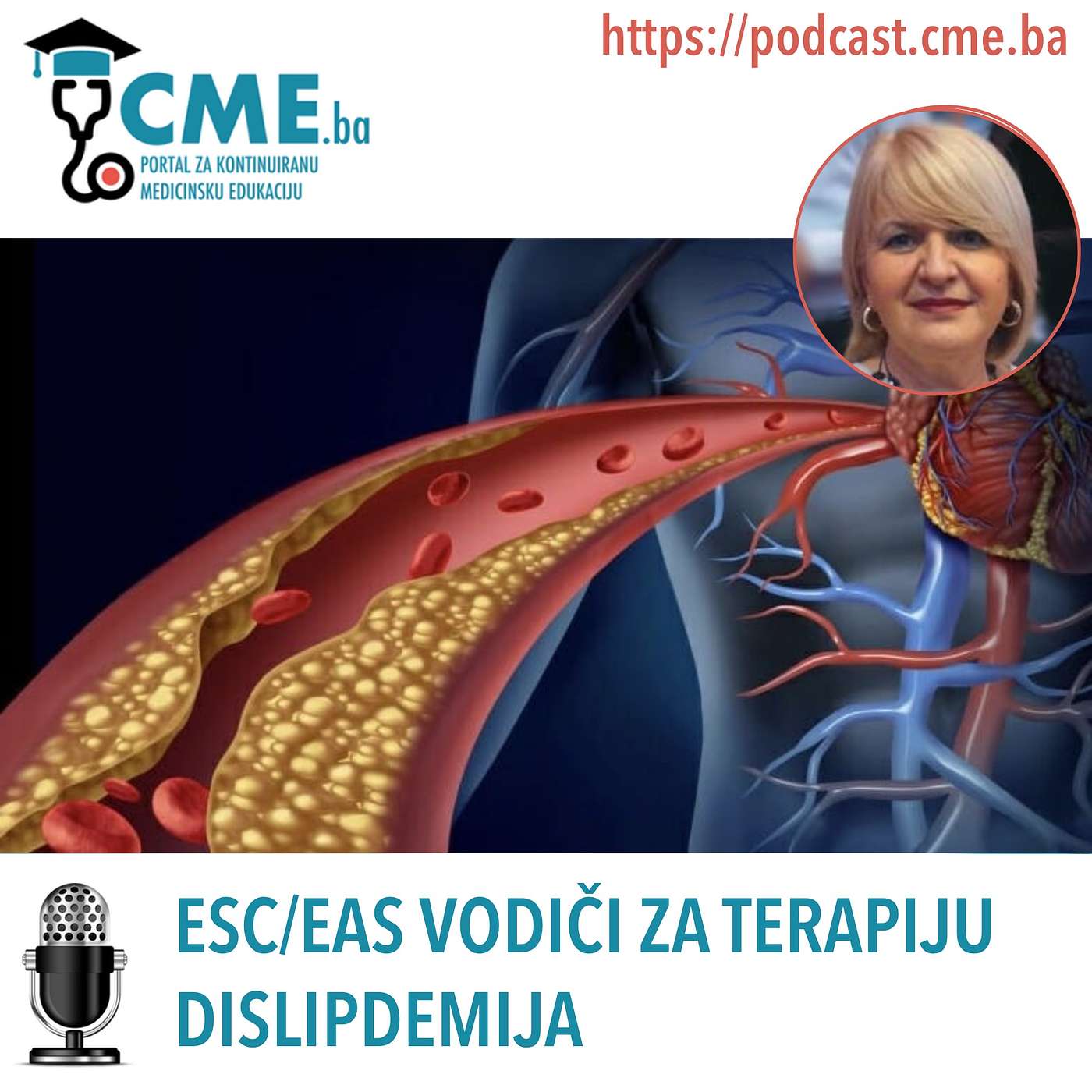 ESC/EAS vodiči za terapiju dislipidemija