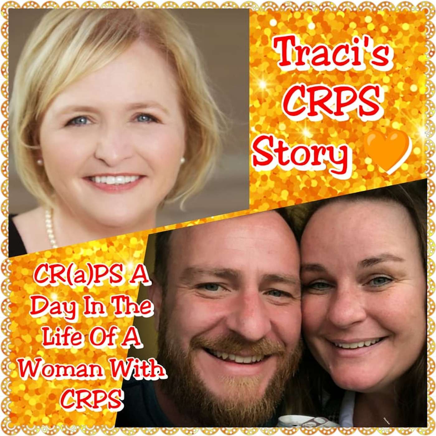 CR(a)PS A Day in a Life with a Woman With CRPS