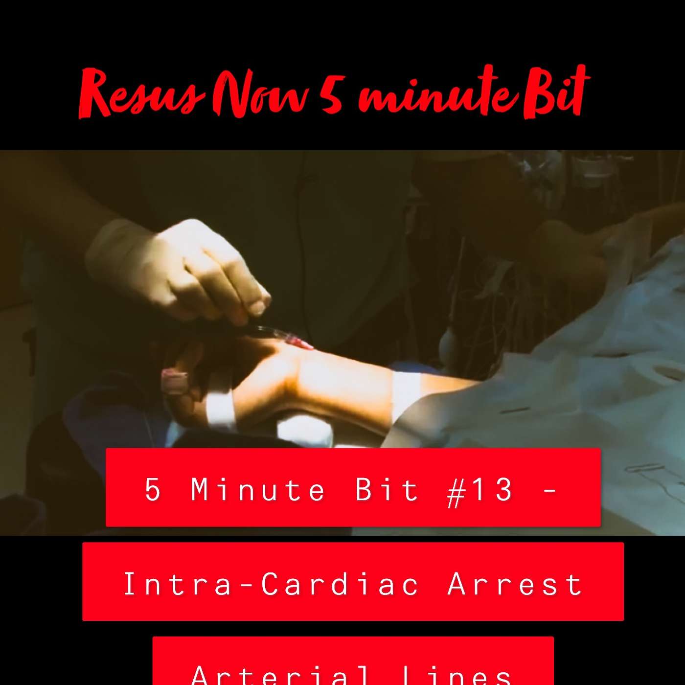 Resus Now