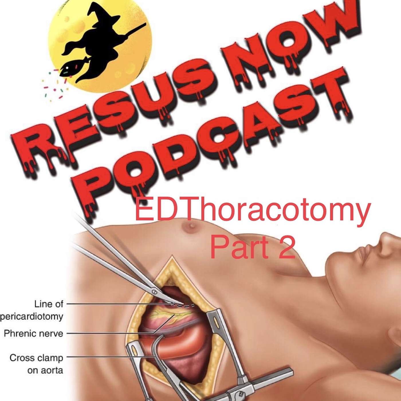 Resus Now