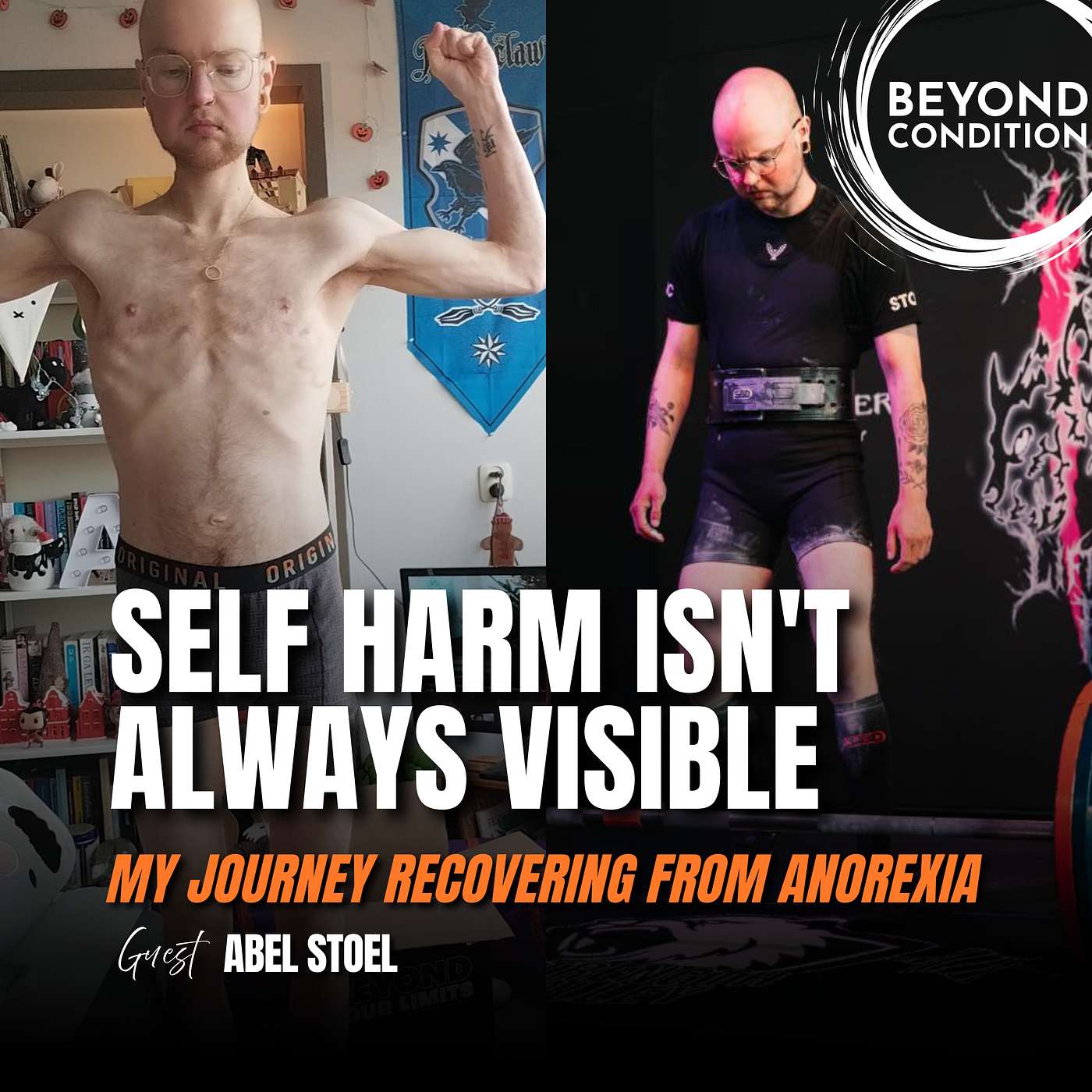 Self Harm Isn't Always Visible | My Journey Recovering From Anorexia Guest. Abel Stoel