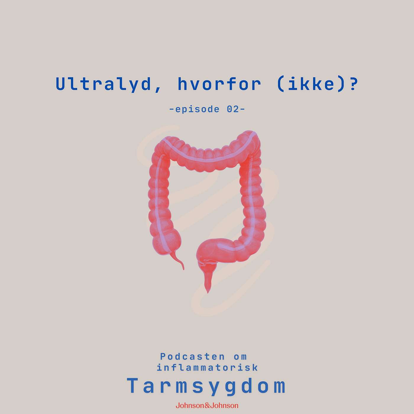 Ultralyd, hvorfor (ikke)?