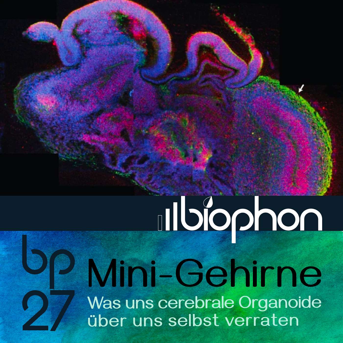 bp27: Mini - Gehirne - Was uns cerebrale Organoide über uns selbst verraten