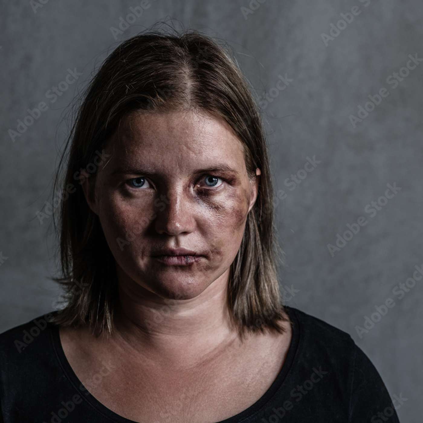 Abused Democrat voter syndrome