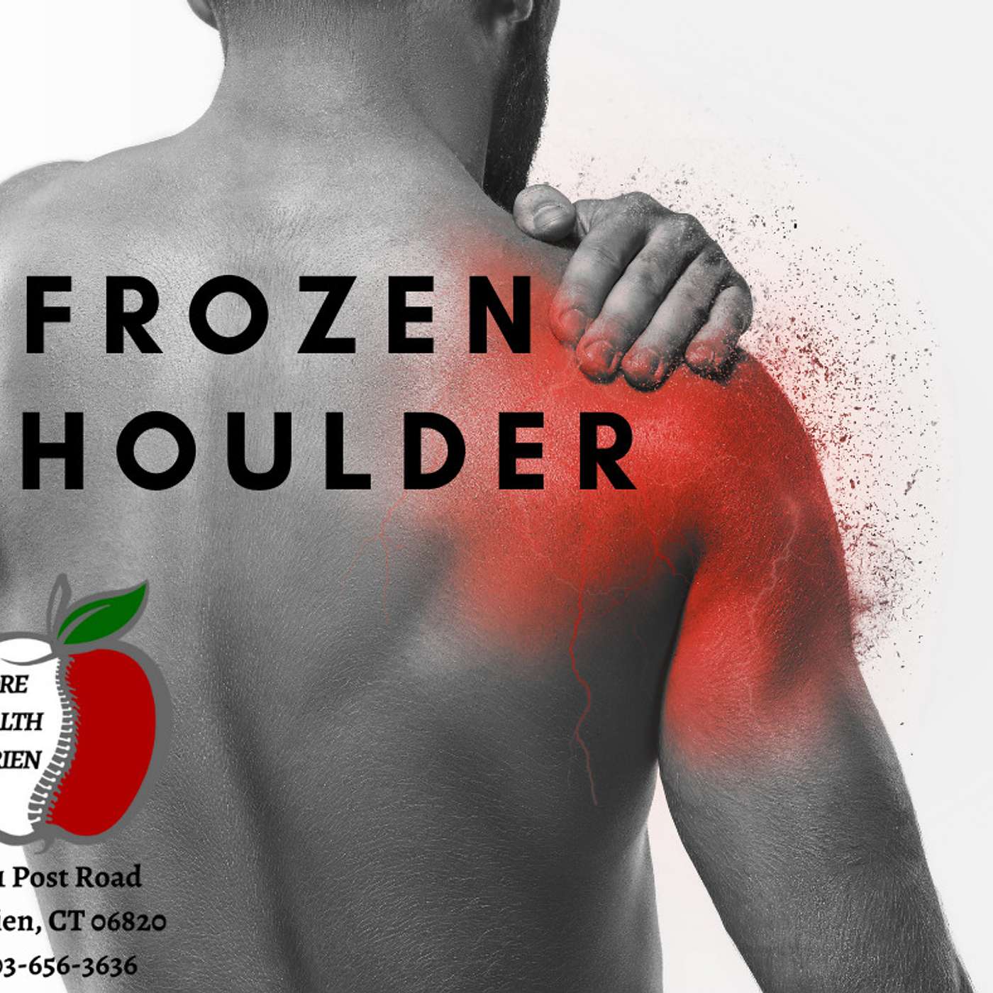Frozen Shoulder Stamford, Darien, Norwalk, New Canaan CT 203-656-3636 episode artwork
