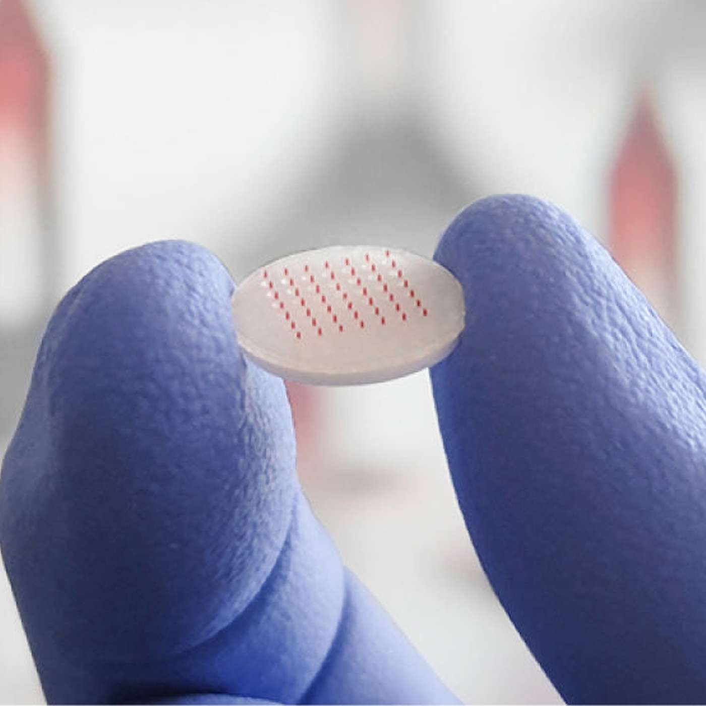 Exploring Future Healthcare: Revolutionary Breakthrough with Soluble Microneedles Technology