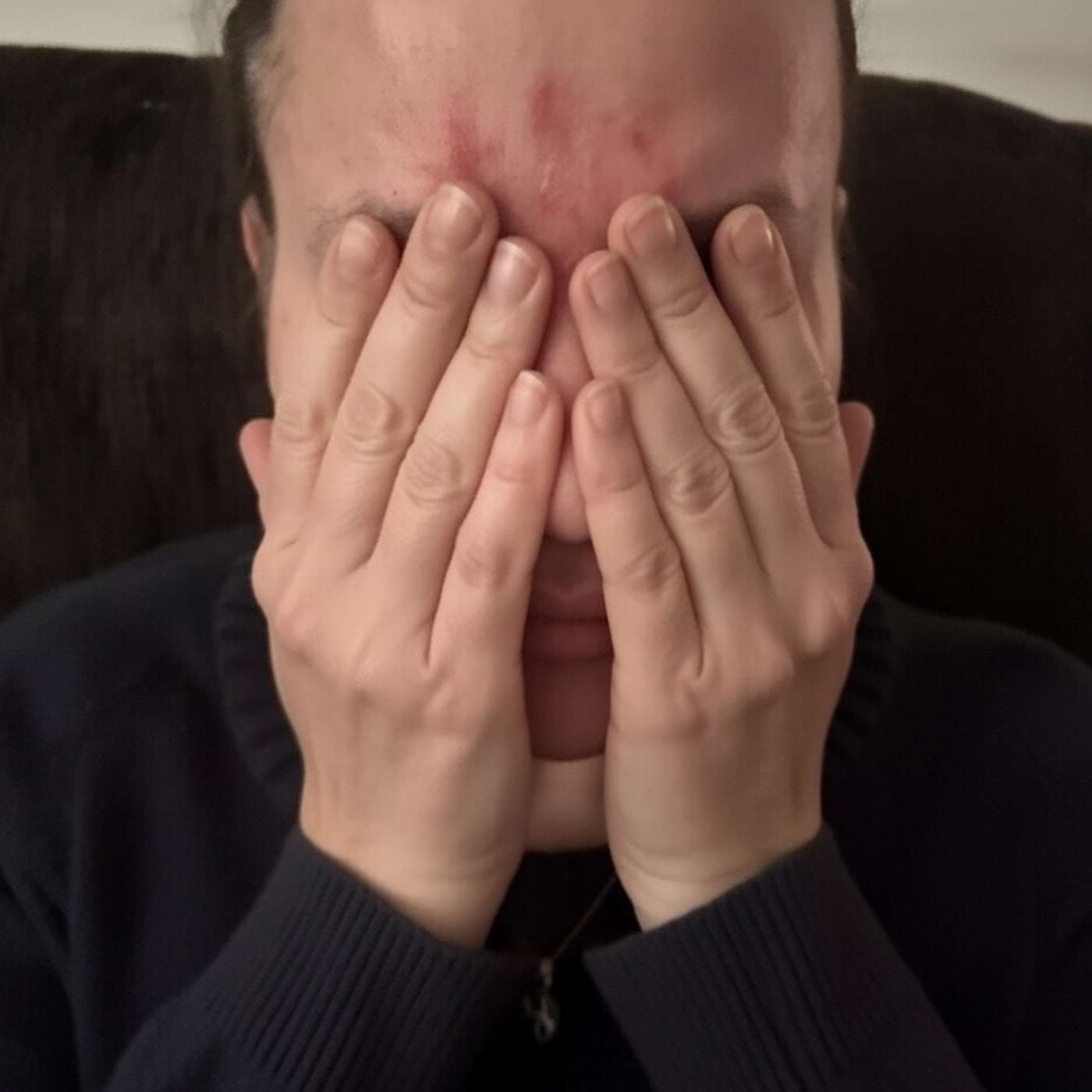 THE ROSACEA METHOD cover art