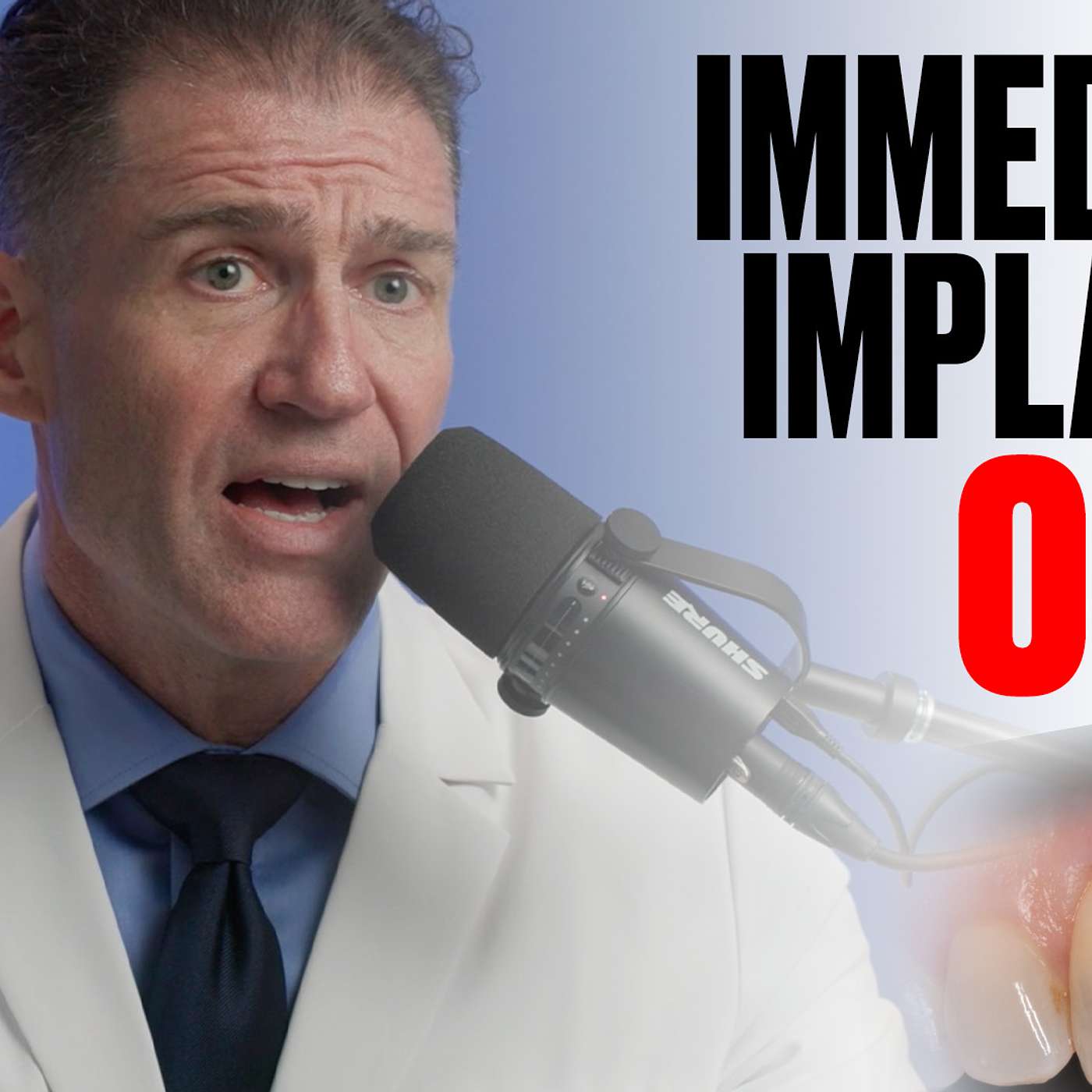 Implants Made Simple